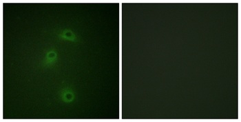DAPK2 (phospho Ser318) rabbit pAb Antibody