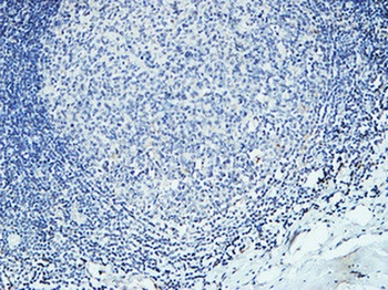 DAPK2 rabbit pAb Antibody