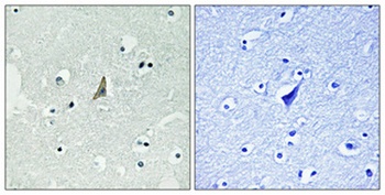 ALK (phospho Tyr1604) rabbit pAb Antibody