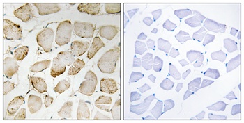 5-LO rabbit pAb Antibody