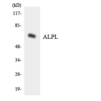 TNAP rabbit pAb Antibody
