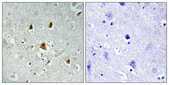Abl1 (phospho Tyr204) rabbit pAb Antibody