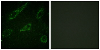 c-Abl (phospho Tyr245) rabbit pAb Antibody