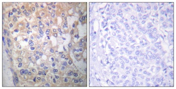 Fyn (phospho Tyr530) rabbit pAb Antibody