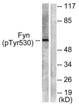 Fyn (phospho Tyr530) rabbit pAb Antibody