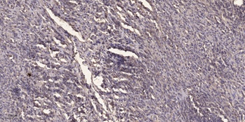 Gab 1 (phospho Tyr307) rabbit pAb Antibody