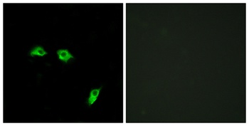 GABAB R1 rabbit pAb Antibody