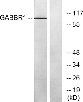 GABAB R1 rabbit pAb Antibody