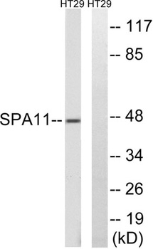Serpin A11 rabbit pAb Antibody
