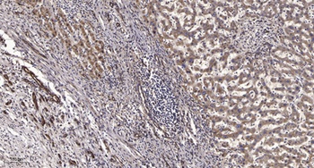 Serpin A11 rabbit pAb Antibody