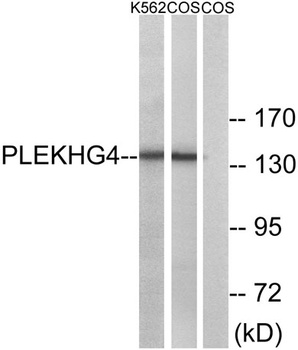 Puratrophin 1 rabbit pAb Antibody