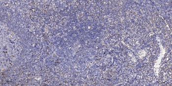 Puratrophin 1 rabbit pAb Antibody