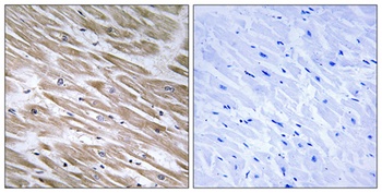 KANK2 rabbit pAb Antibody