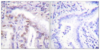 SENP6 rabbit pAb Antibody