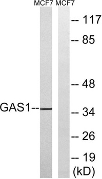 Gas1 rabbit pAb Antibody