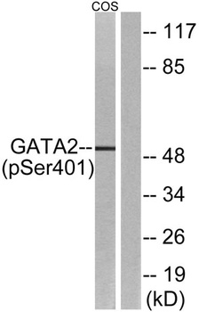 GATA-2 (phospho Ser401) rabbit pAb Antibody