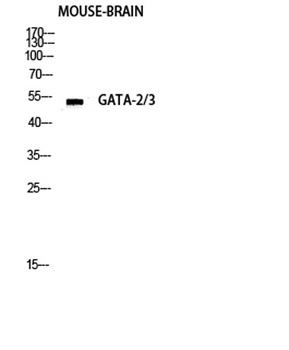 GATA-2/3 rabbit pAb Antibody