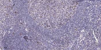 GATA-4 (phospho Ser105) rabbit pAb Antibody