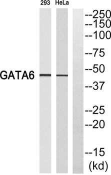 GATA-6 rabbit pAb Antibody