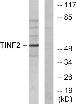TIN2 rabbit pAb Antibody