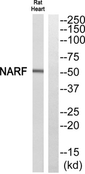 NARF rabbit pAb Antibody