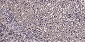 NARF rabbit pAb Antibody