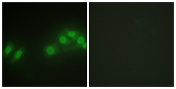 Kpm rabbit pAb Antibody