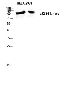 p52 S6 kinase rabbit pAb Antibody