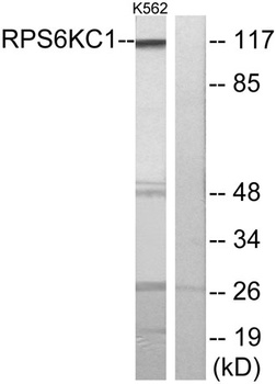 p52 S6 kinase rabbit pAb Antibody