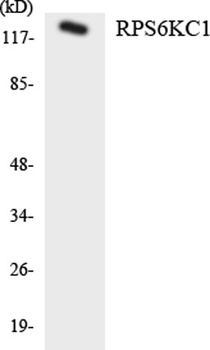 p52 S6 kinase rabbit pAb Antibody