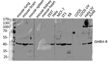 GHRH-R rabbit pAb Antibody