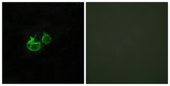 GHRH-R rabbit pAb Antibody