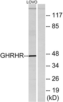 GHRH-R rabbit pAb Antibody