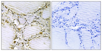AMPD1 rabbit pAb Antibody