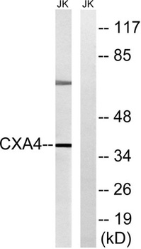 Connexin 37 rabbit pAb Antibody