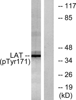 LAT (phospho Tyr200) rabbit pAb Antibody