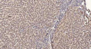 LAT (phospho Tyr200) rabbit pAb Antibody
