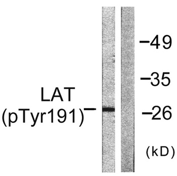 LAT (phospho Tyr191) rabbit pAb Antibody