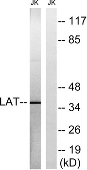 LAT rabbit pAb Antibody