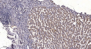 LAT rabbit pAb Antibody
