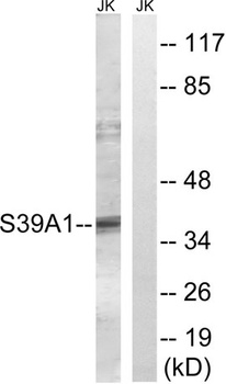 ZIP1 rabbit pAb Antibody