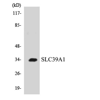 ZIP1 rabbit pAb Antibody