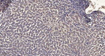 AMPD3 rabbit pAb Antibody
