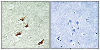 Pdcd-4 (phospho Ser67) rabbit pAb Antibody