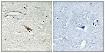 Pdcd-4 (phospho Ser67) rabbit pAb Antibody