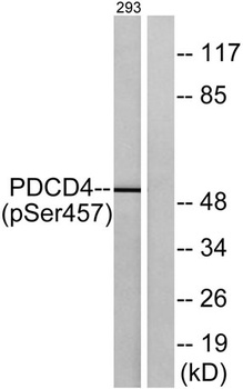 Pdcd-4 (phospho Ser457) rabbit pAb Antibody