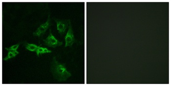 GnRH-R rabbit pAb Antibody