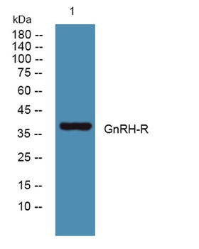 GnRH-R rabbit pAb Antibody