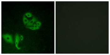 GPR20 rabbit pAb Antibody