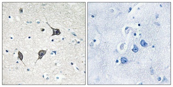 GPR20 rabbit pAb Antibody